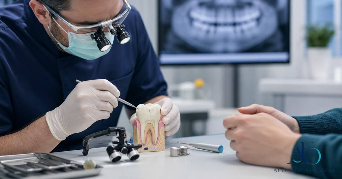 Modelo dental com dente trincado causando dor ao mastigar em Taboão da Serra