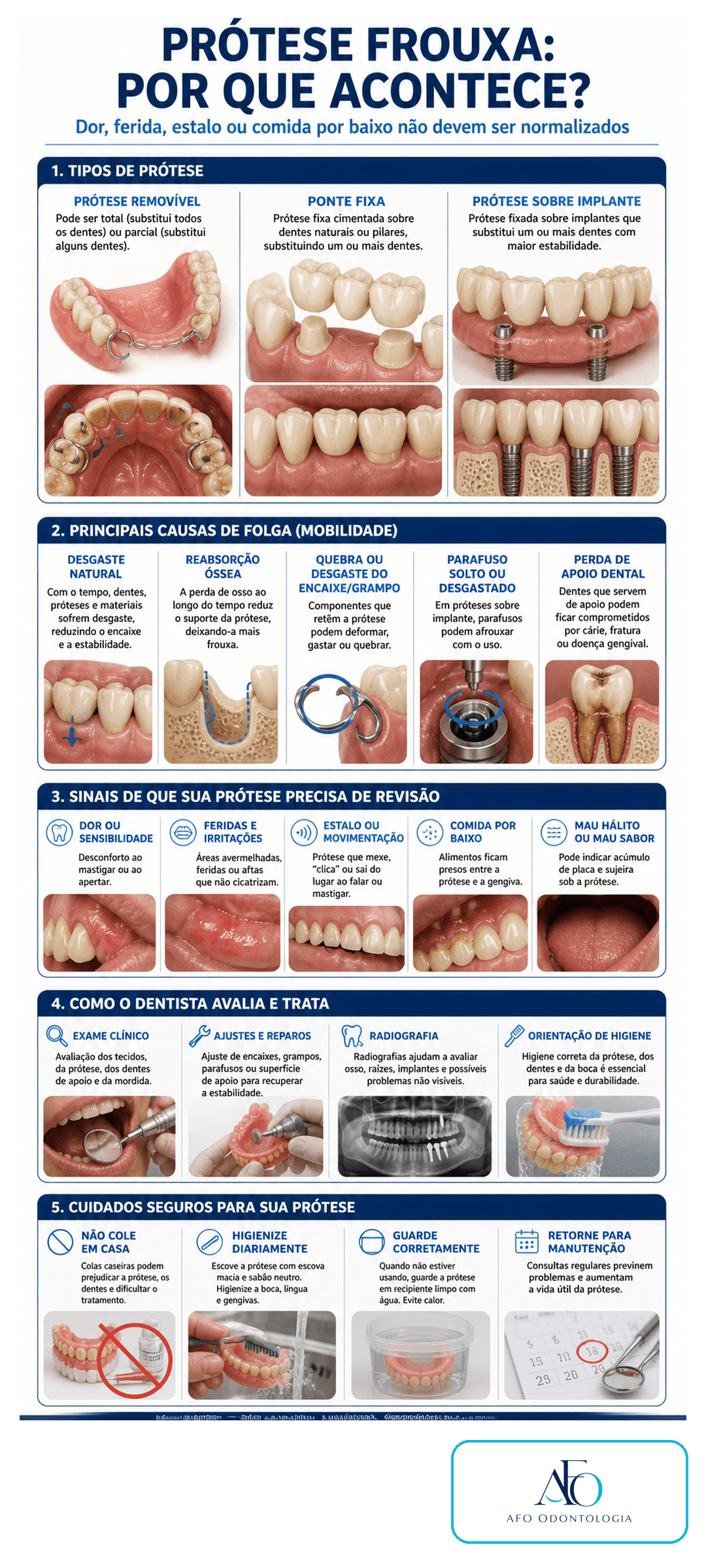 Infográfico sobre causas de prótese dentária frouxa, revisão, ajustes e cuidados seguros
