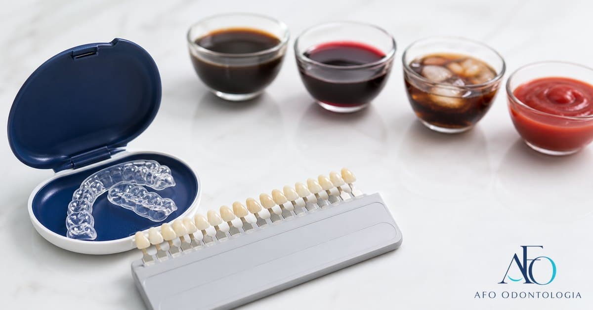 Mesa com cafe, vinho, molho escuro e alimentos claros para orientar o que evitar apos clareamento dental em Taboao da Serra
