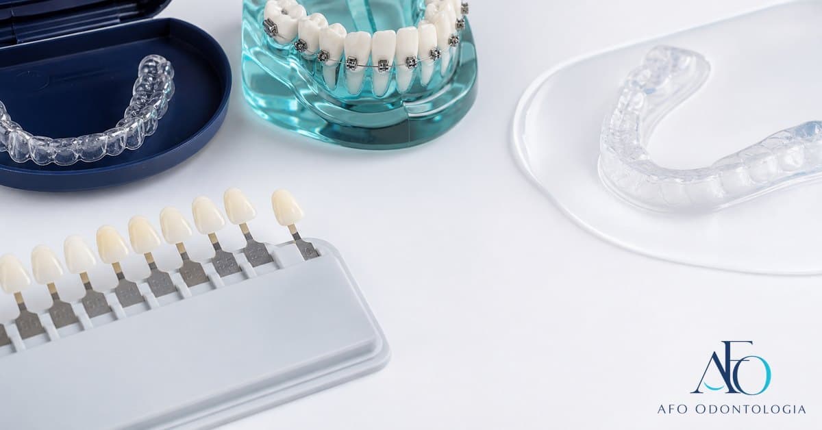 Aparelho ortodontico e moldeira de clareamento ao lado de dentes claros, mostrando a ordem do tratamento em Taboao da Serra