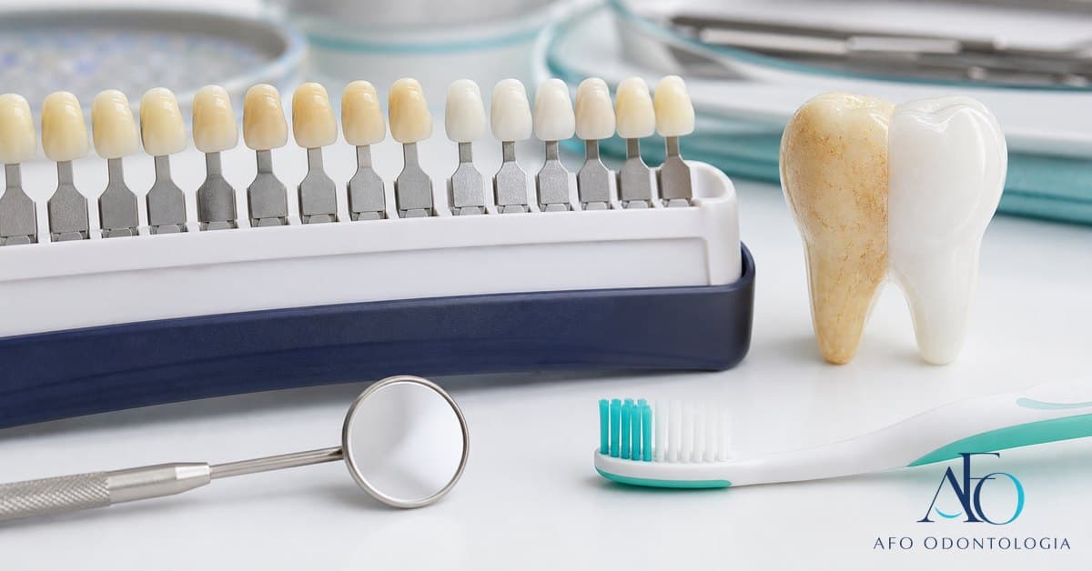 Sorriso com dentes levemente amarelados e quadro comparativo de manchas, ilustrando cor natural do dente em Taboao da Serra