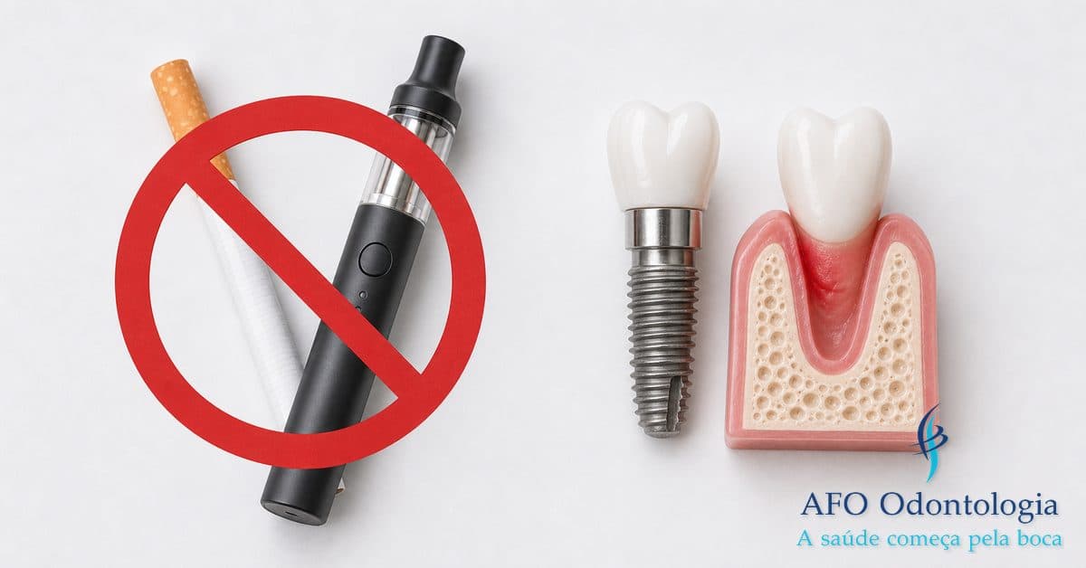 Tabagismo e implante dentário — cigarro e vape aumentam risco de falha na osseointegração, Taboão da Serra