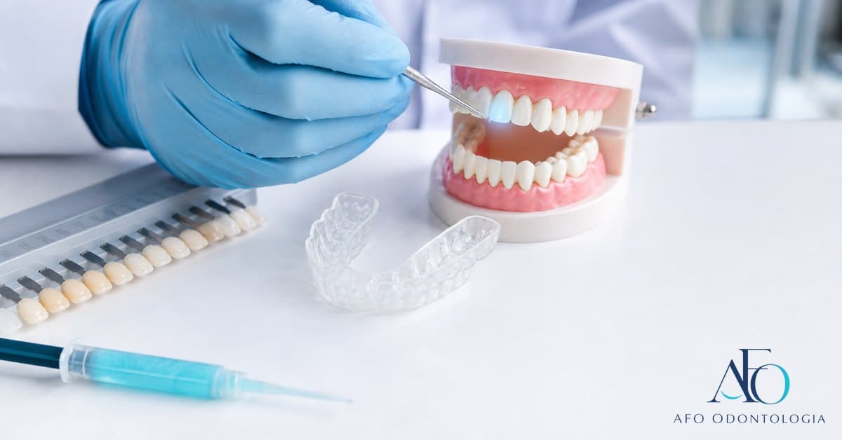 Dente com indicador de sensibilidade, moldeira e gel clareador, ilustrando desconforto durante clareamento dental em Taboao da Serra