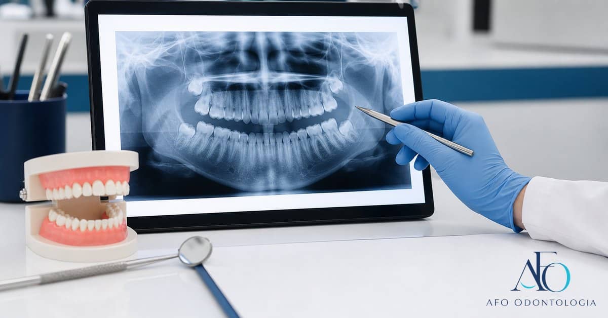 Radiografia panoramica odontologica usada para planejamento em Tabao da Serra