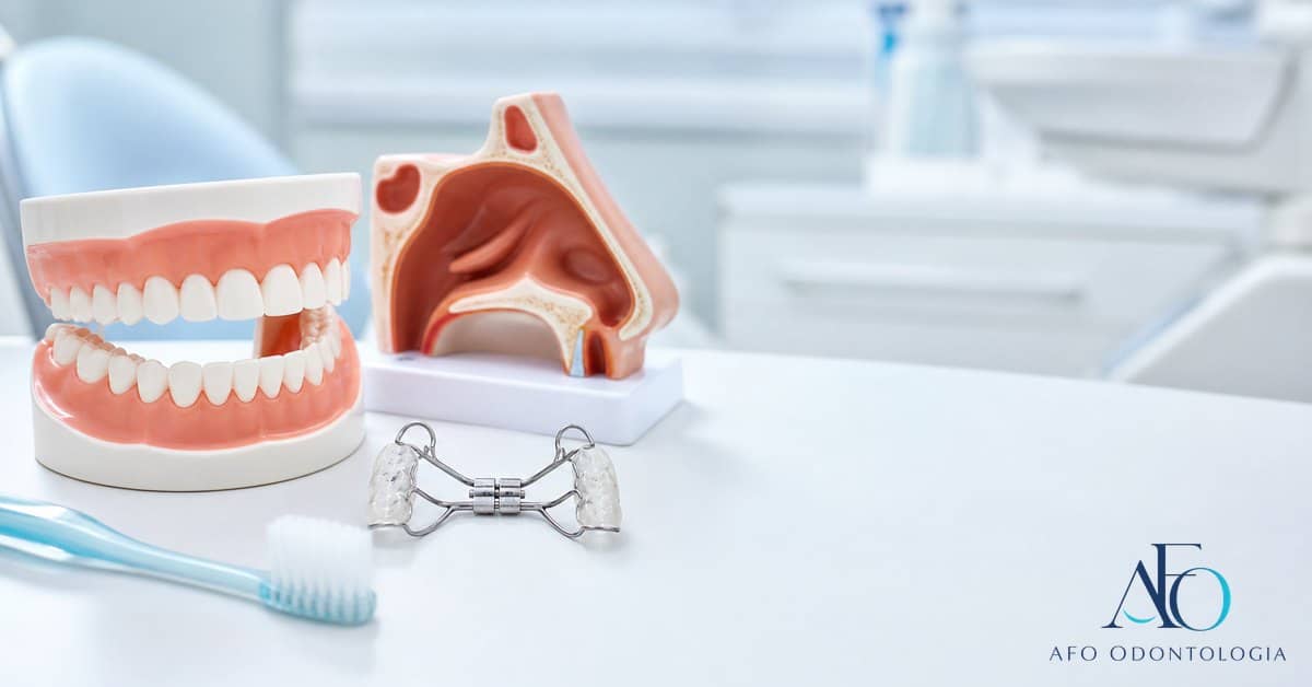 Modelo dental e anatomia nasal ilustrando respiracao bucal e ortodontia em Tabao da Serra