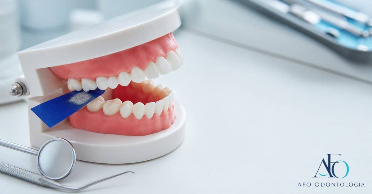 Dentista avaliando mordida com papel carbono odontológico e logo novo da AFO