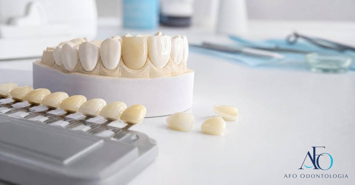 Sorriso em close com escala de cor odontológica e logo novo da AFO
