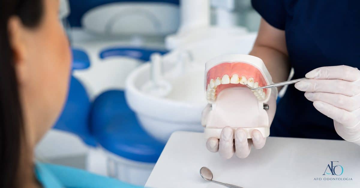 Dentista explicando riscos do tartaro nao tratado