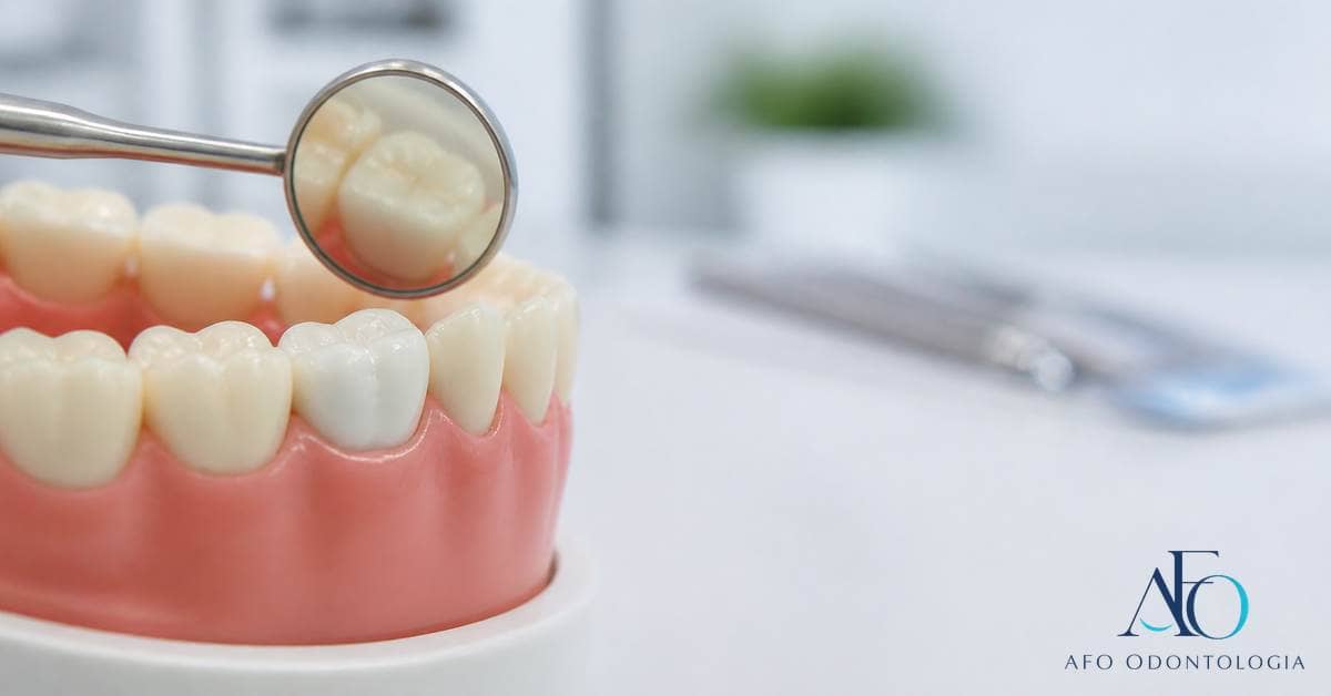 Modelo dental com restauração destacada e espelho sem simular diagnóstico