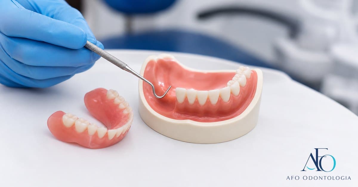 Prótese dentária frouxa em modelo clínico, mostrando perda de encaixe em Taboão da Serra