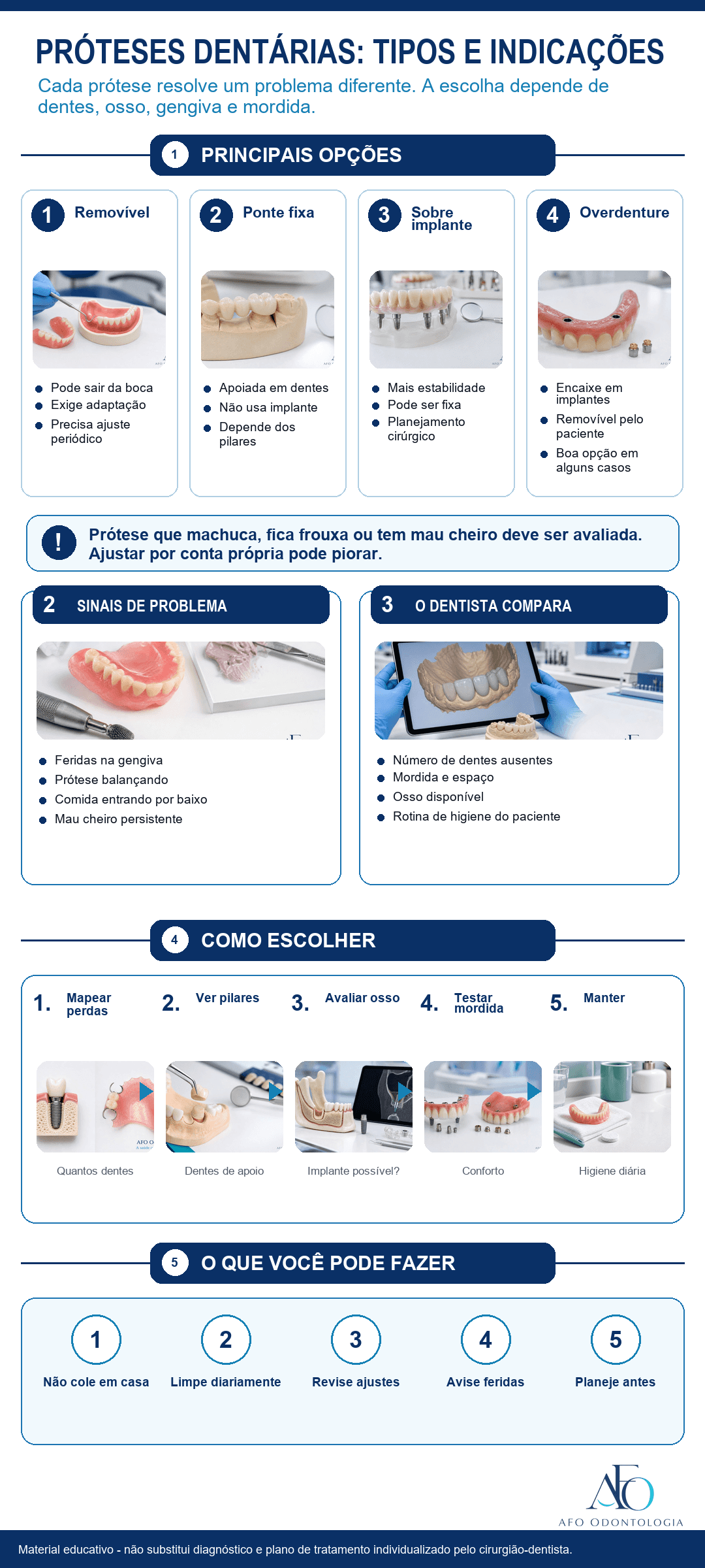 Infográfico comparando prótese removível, ponte fixa, prótese sobre implante e overdenture