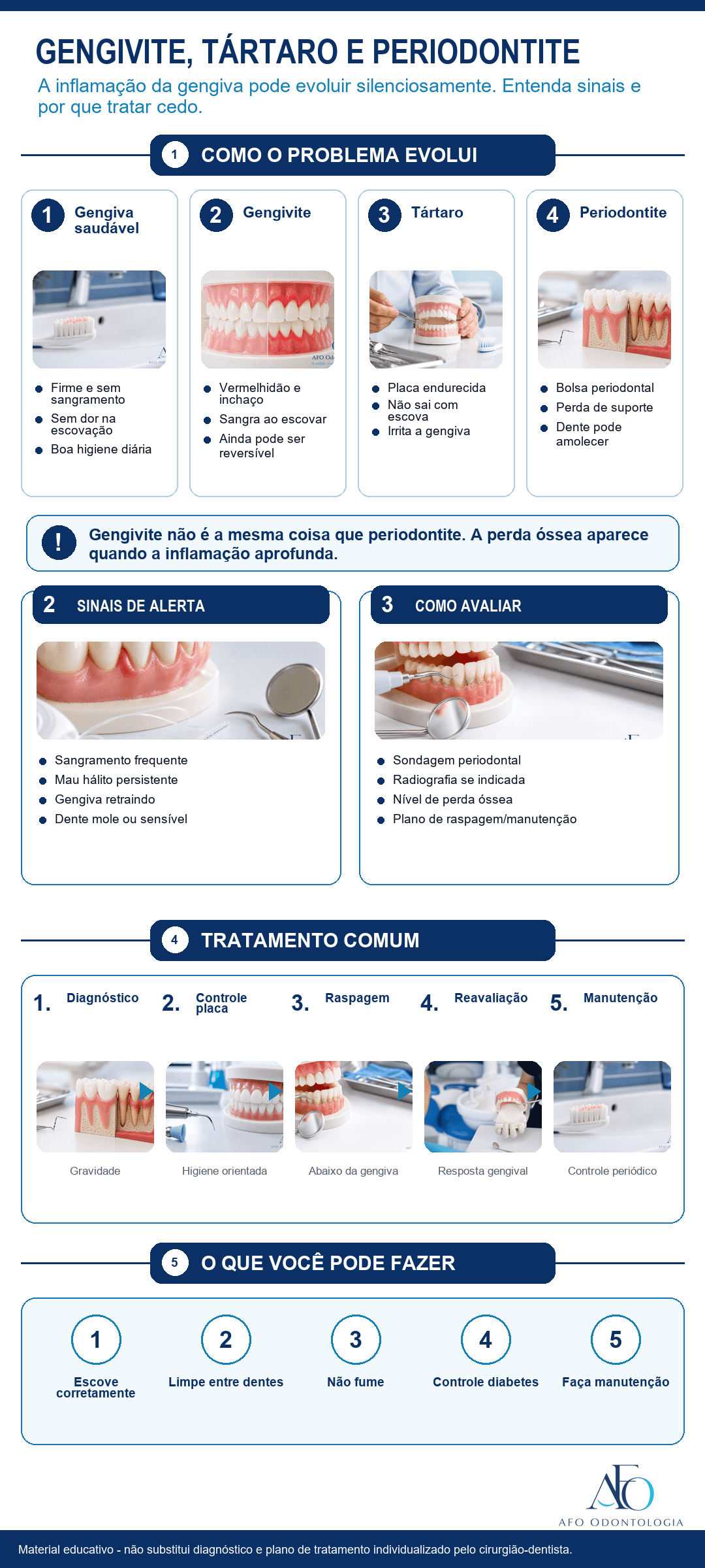Infográfico sobre evolução de gengivite, tártaro e periodontite com sinais de alerta