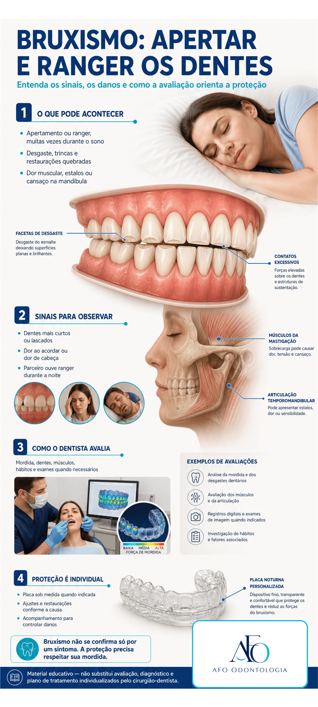 Infográfico sobre bruxismo, apertamento dental, ranger dos dentes, músculos mastigatórios e placa noturna